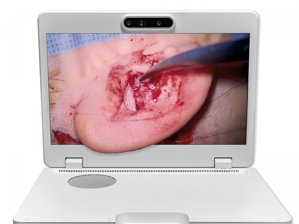 达擎之＂Heads-up 3D显微手术显示系统＂，整合4K裸眼3D显示及眼球追踪系统，具备快速追踪人眼移动位置功能，减轻医师长时间维持固定姿势的负担，让医师能有更宽广清晰的3D立体视野及更舒适的姿势来执行手术。